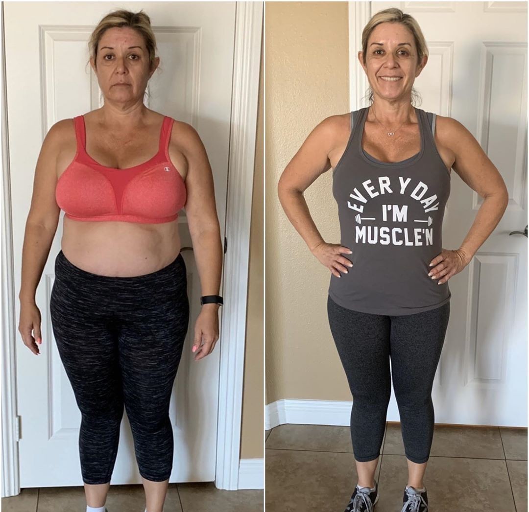 Antes e depois — Rosana, 49