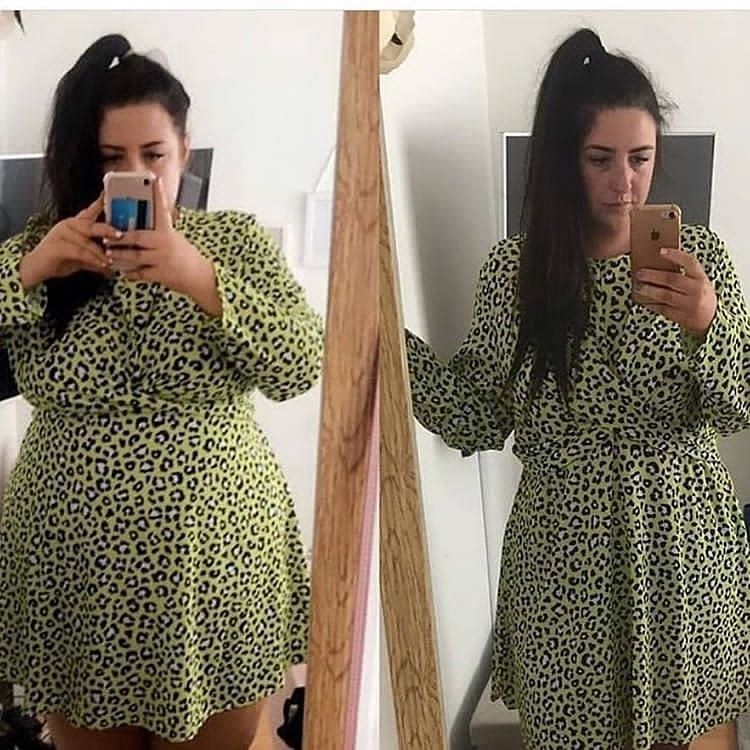 Antes e depois — Fernanda, 34