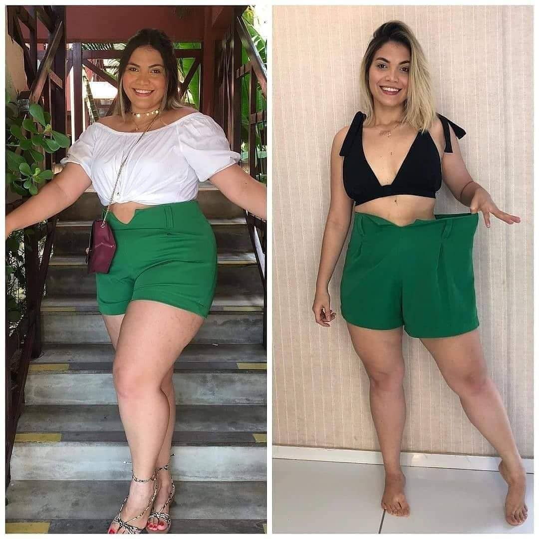 Antes e depois — Camila, 29