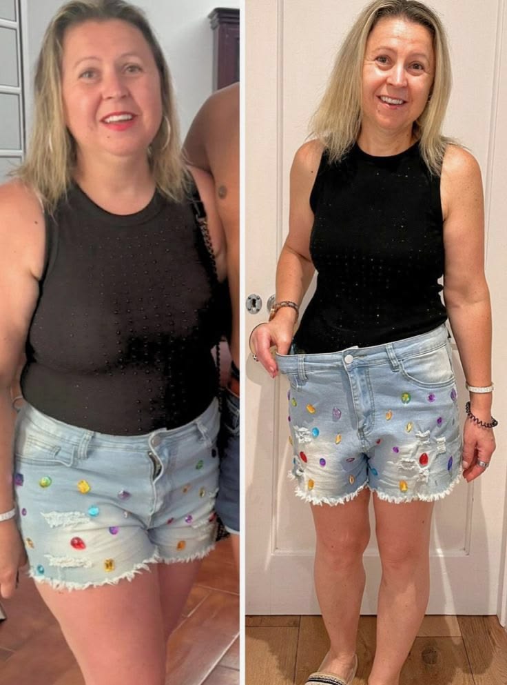 Antes e depois — Maria, 47