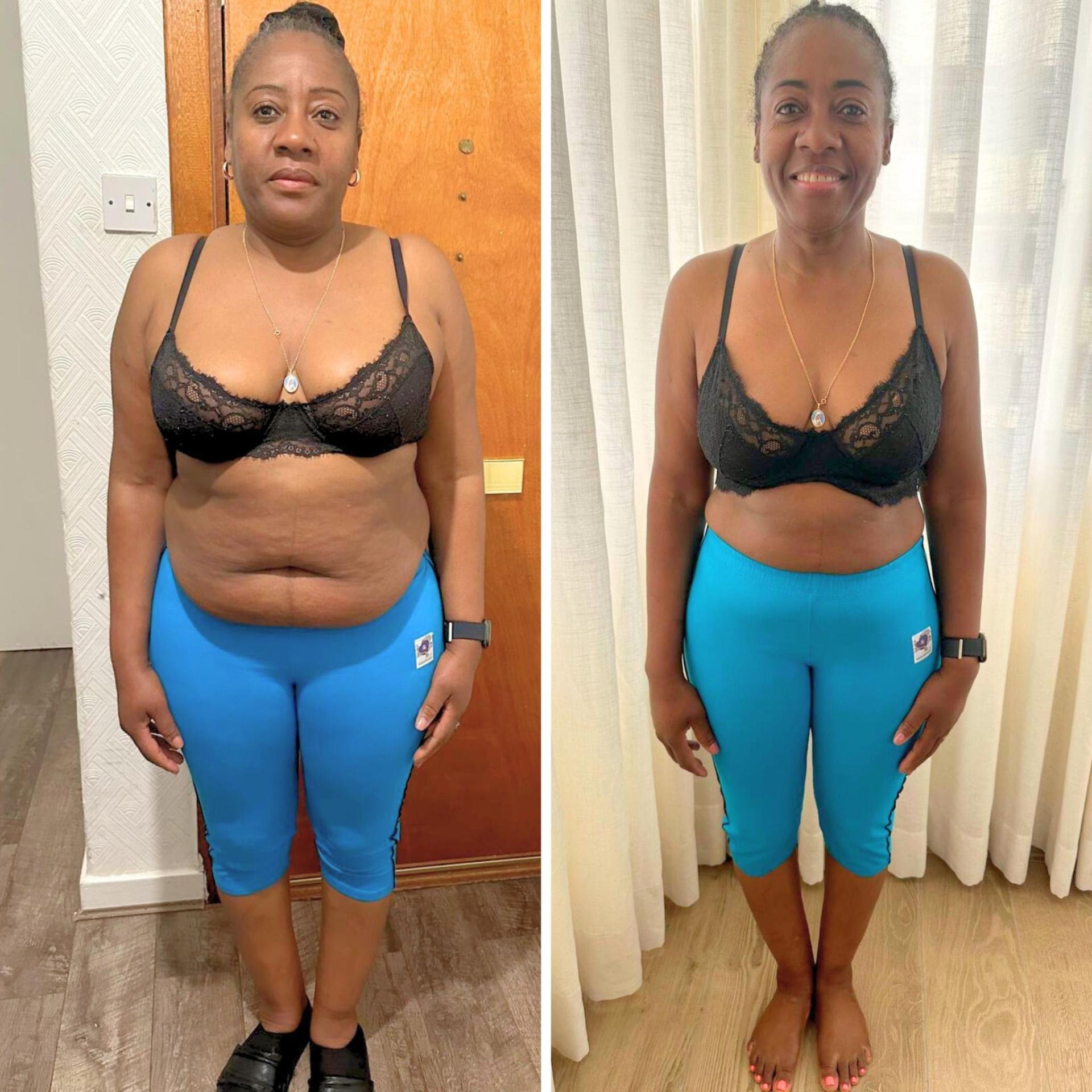 Antes e depois — Joana, 52